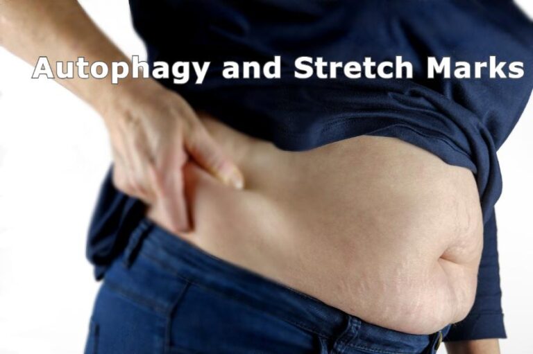 autophagy stretch marks