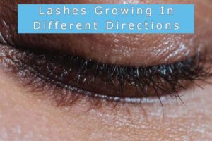 Why My Eyelashes Are Growing In Weird & Different Directions?