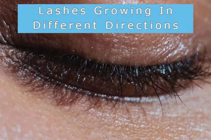 eyelashes growing in different directions